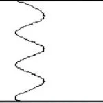 ridge pattern 3